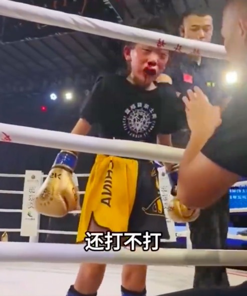 女孩挑战金腰带选手被打得鼻青眼肿(图1)
