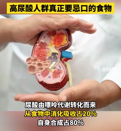 中国人的尿酸为啥越来越高了 高尿酸人群真正要忌口的食物