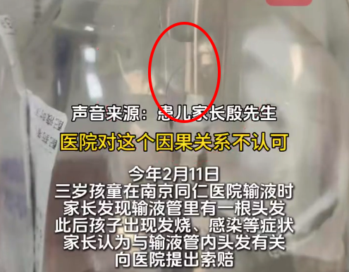 三岁患儿输液管内发现头发 涉事医院回应输液管异物