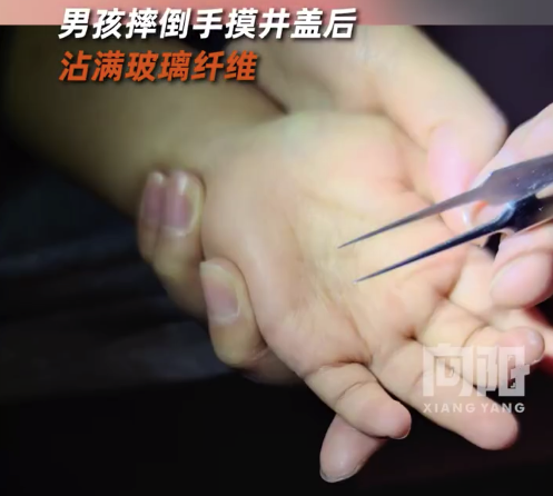 危险!小孩误触井盖后手疼疑摸到玻璃纤维