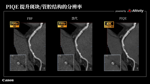 直击进博会 | 佳能医疗全球科技成果集中亮相