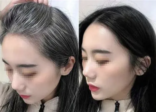 桂圆琼玉颗粒:解决头发早白的中医调理新选择