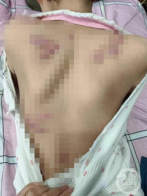 13岁男孩砍伤9岁女童致其缝200针，未满14岁不负刑事责任