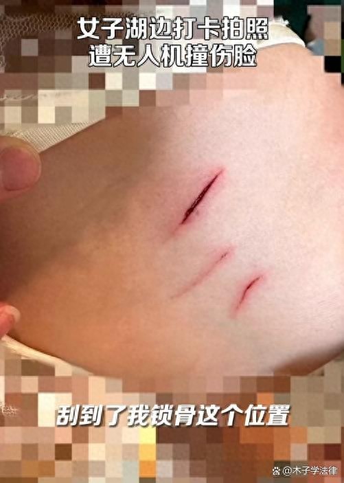 女子湖边打卡遭无人机撞脸划破锁骨 美丽瞬间背后的惊险一幕