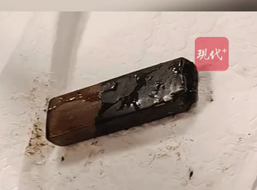 男子胃疼才想起7年前误吞过打火机 目前已被完整取出