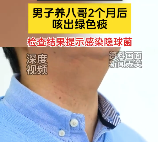 男子经常与八哥亲密接触感染隐球菌