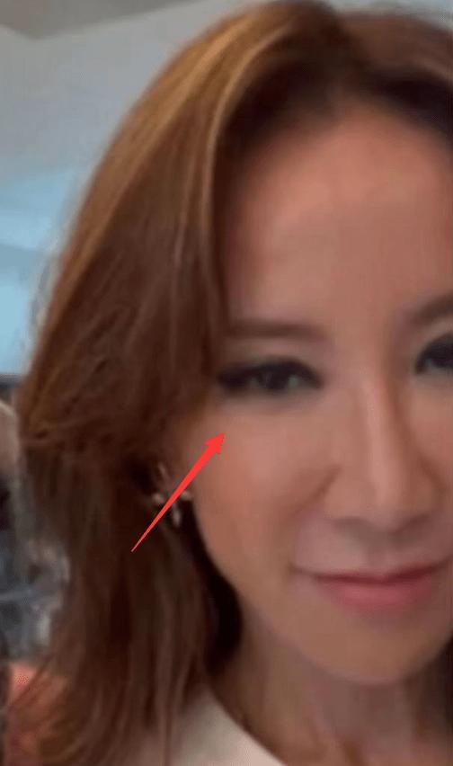 李玟生前与妈妈合影曝光：黑眼圈很明显