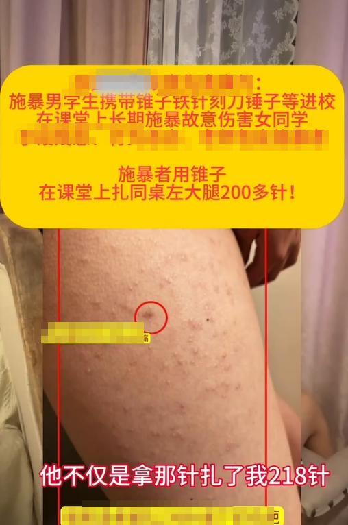 女生被同桌用铁锥扎数百下？官方回应：非校园霸凌，调解未果