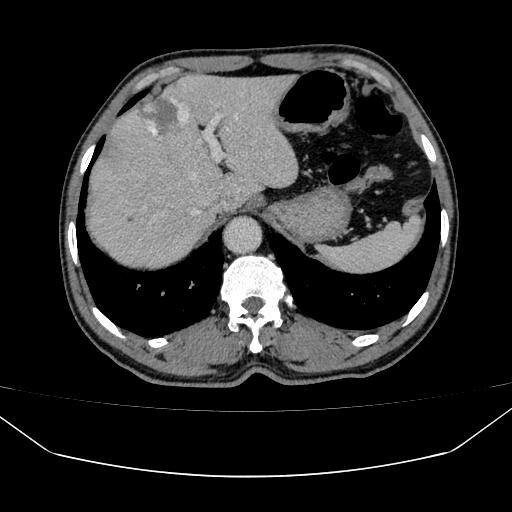 济南市莱芜区新服务上线:上腹增强CT,守护居民健康