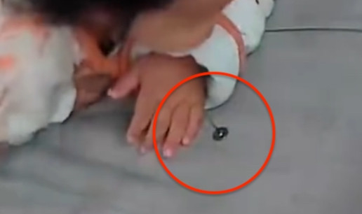 妈妈以为宝宝吐奶拍背后吐出图钉 医生：极其危险