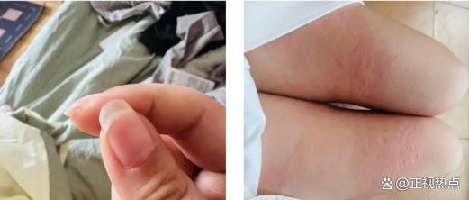 女子称出差遭性侵男方被刑拘后不予起诉 司法认定引争议