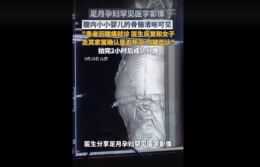 女子腹痛就诊后2小时分娩 影像检查前否认怀孕