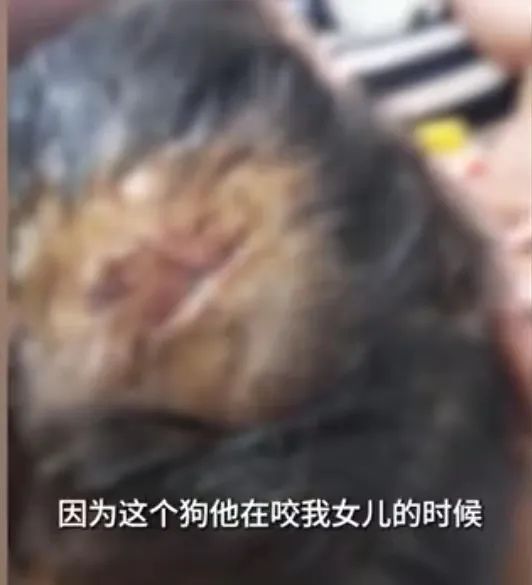 女子疑遛狗不牵绳咬伤人，狗主人不承认狗曾咬人，还要受伤方赔偿狗的医药费