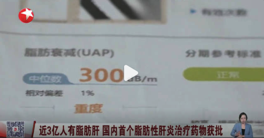 国内首个脂肪性肝炎治疗药来了 我国有近3亿脂肪肝患者