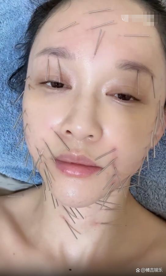 46歲陳喬恩曬做針雕保養(yǎng)照曝光