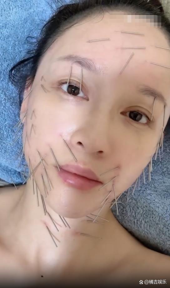 46歲陳喬恩曬做針雕保養(yǎng)照曝光