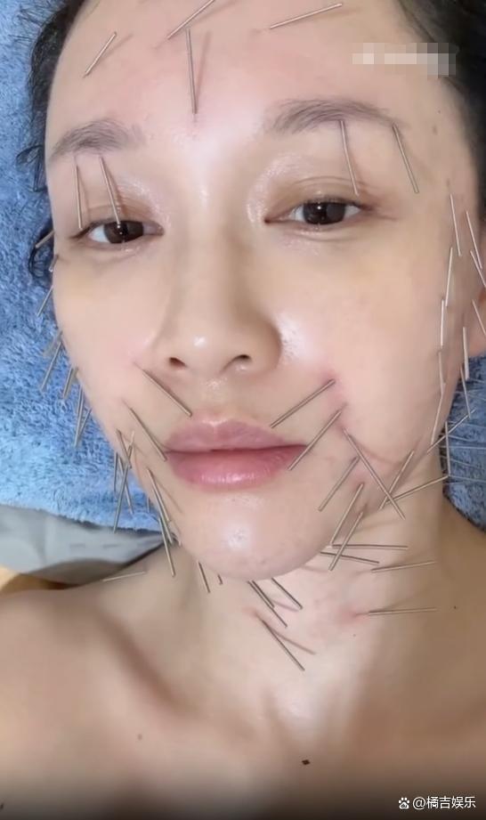 46歲陳喬恩曬做針雕保養(yǎng)照曝光