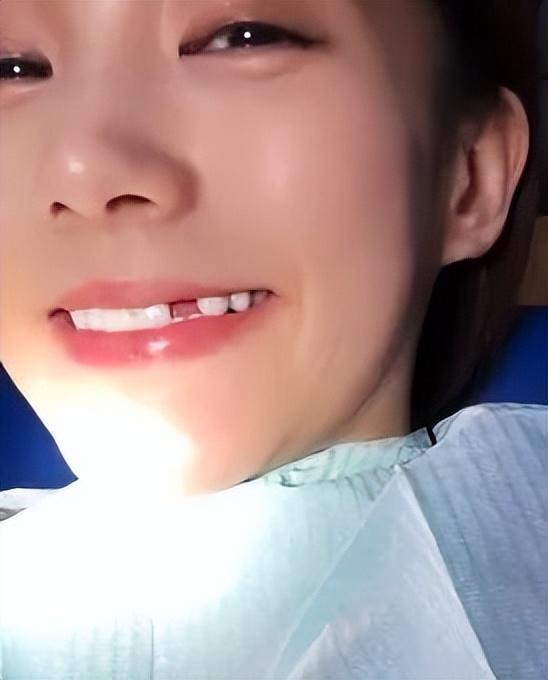 『李一桐』掉牙照被做成白云表情包 乐观态度获赞