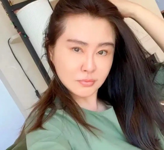 网传王祖贤医美痕迹 被质疑医美填充、提拉过度或出现后遗症