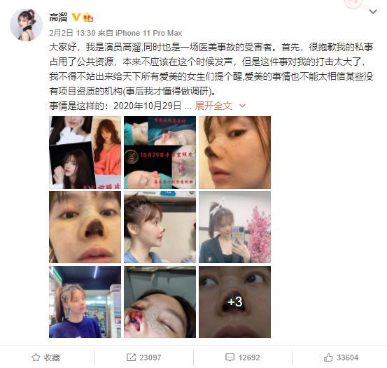 女演员高溜整容失败鼻尖坏死 院方：在走司法程序