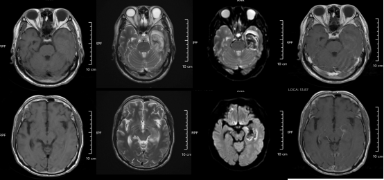 30岁小伙长期熬夜智力退回3岁