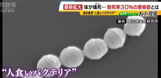 日本食人菌感染今年已致超250人死亡 防控警报升级