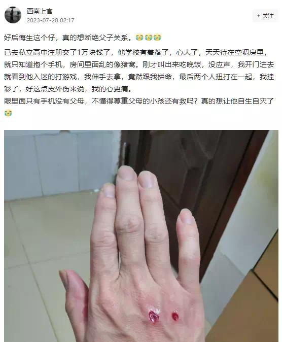 网友称因游戏被儿子打伤，真想让他自生自灭了