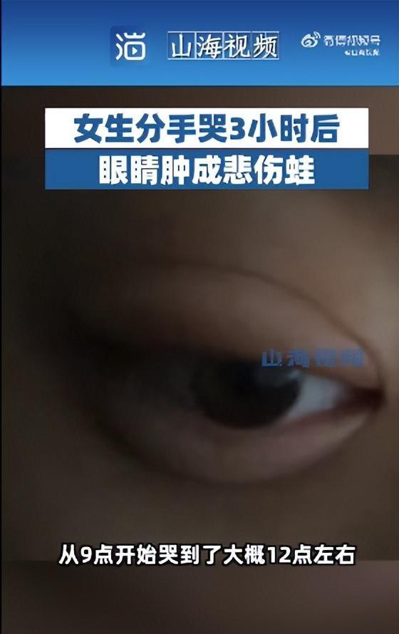 女生哭3小时成“悲伤蛙” 网友：简直就是青蛙本蛙