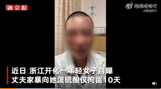 警方通报男子泼女子硫酸 女子浓硫酸烧伤11%双眼烧伤双耳烧伤