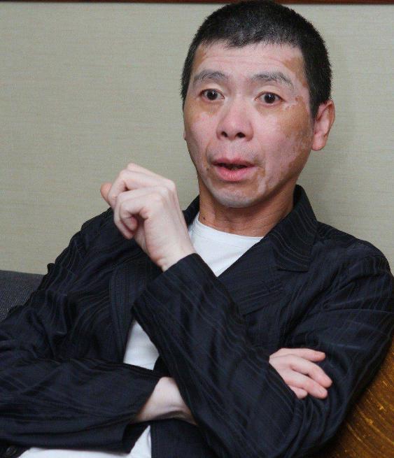 要知道,冯小刚年轻的时候,脸上就一块白一块黄,走在人群中非常的显眼