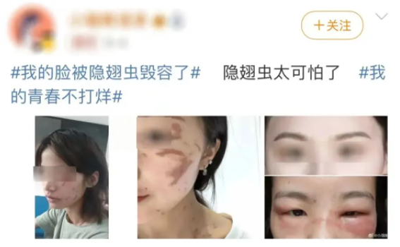 毒液堪比硫酸 一地确诊200多例！防护指南来了
