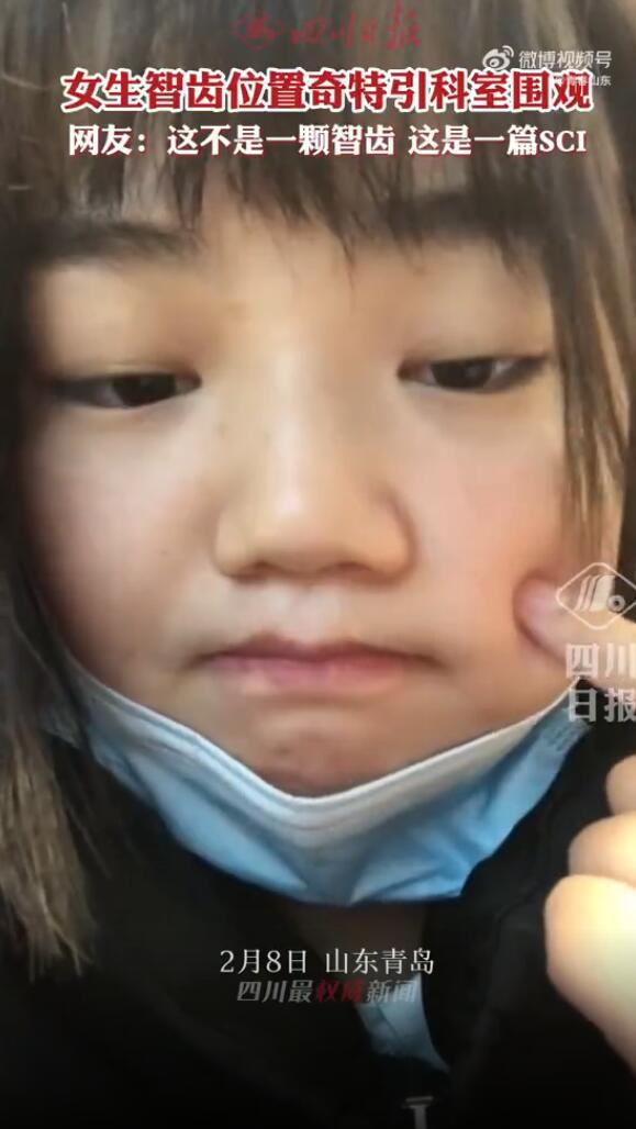 女子智齿位置奇特目测要背井离乡