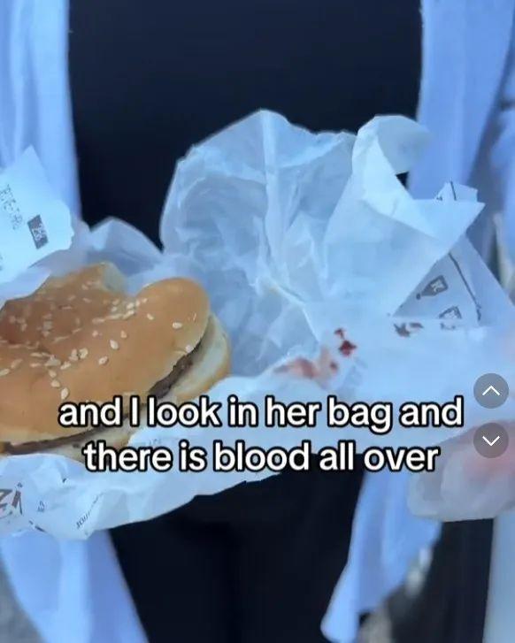 美国4岁女童吃汉堡王吃出人血 食品安全引众怒
