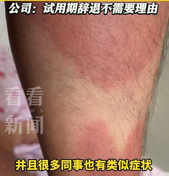 中国男子举报澳洲肉厂安全问题被辞 涉嫌报复性解雇