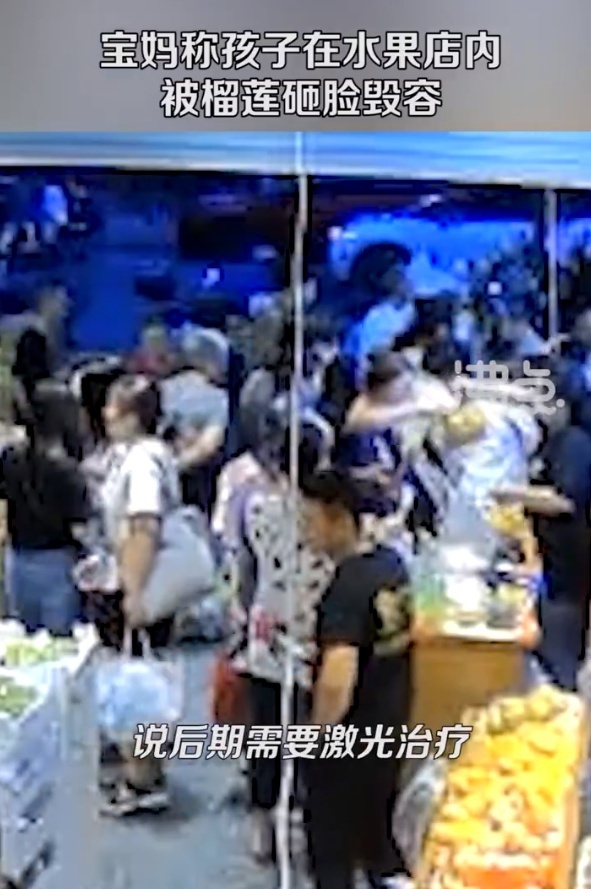 宝妈称孩子被水果店榴莲砸毁容 商家拒绝支付后期治疗费用