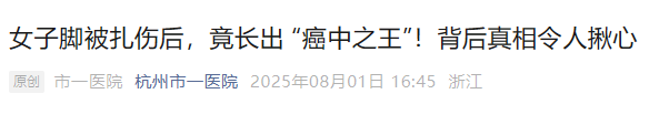 女子脚被扎伤后竟长出 “癌中之王”！医生提醒