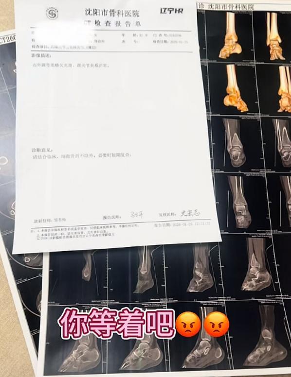 女子被丈夫驾车碾过 意外因雪滑引发