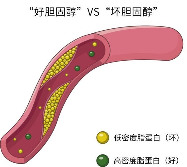 降脂有道，一文告诉你胆固醇高怎么降低