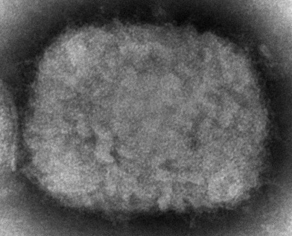 欧美至少8国发现猴痘确诊 疑似病例：感染源未确认
