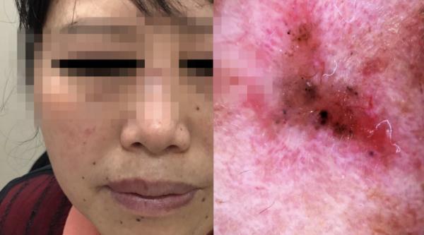 女子陪闺蜜看病，结果自己查出癌症！医生：我一眼就看出来了