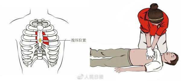 这些实用安全知识关键时刻能救命 常用急救知识合集