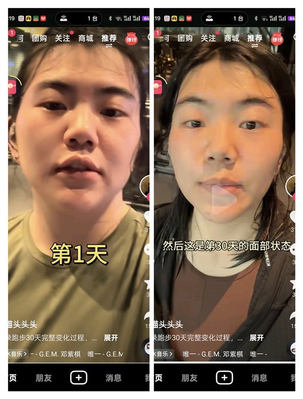 女生跑步30天瘦臉效果驚人 性價比最高醫(yī)美