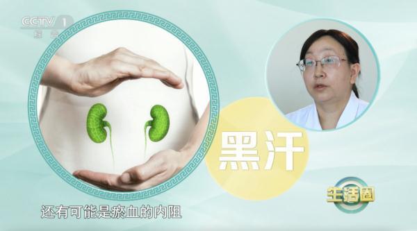 出汗部位暗示疾病風險可能身體出了問題