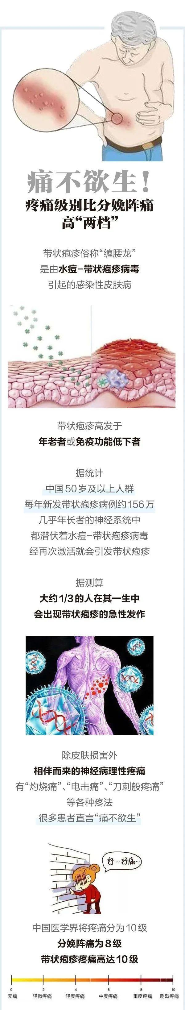 帶狀皰疹發(fā)病的主要原因 免疫力下降引關(guān)注