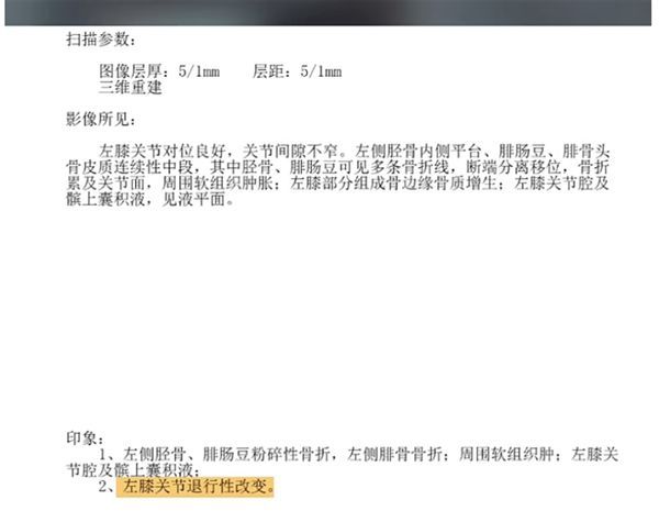 周鸿祎攀岩摔伤致左膝粉碎性骨折 恢复周期不容乐观