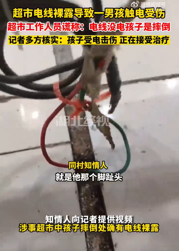 男孩被裸露电线电击晕倒 镇政府回应：已脱离生命危险