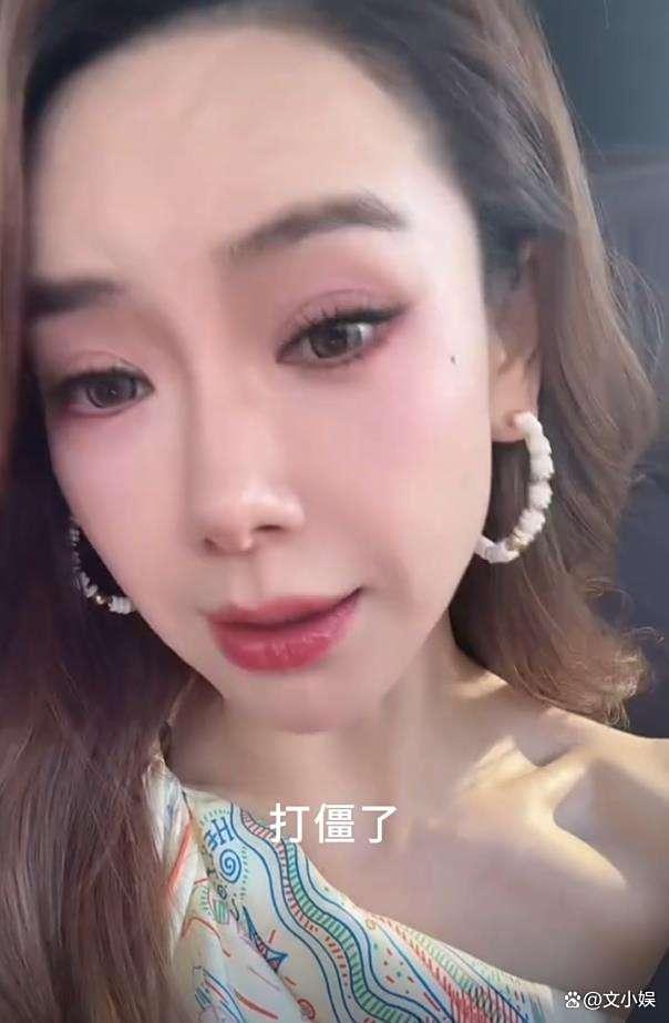 戚薇回应“吊梢眼”：打肉毒打僵了 自黑式坦诚圈粉无数