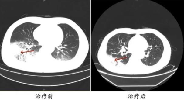 3天空調(diào)吹出“白肺”,！高溫來了，這個(gè)細(xì)節(jié)要當(dāng)心