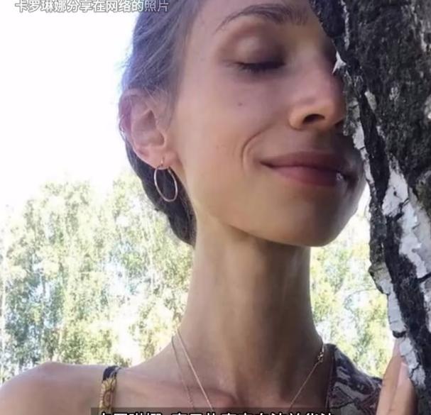只吃水果女子去世前体重仅44斤 极端饮食悲剧
