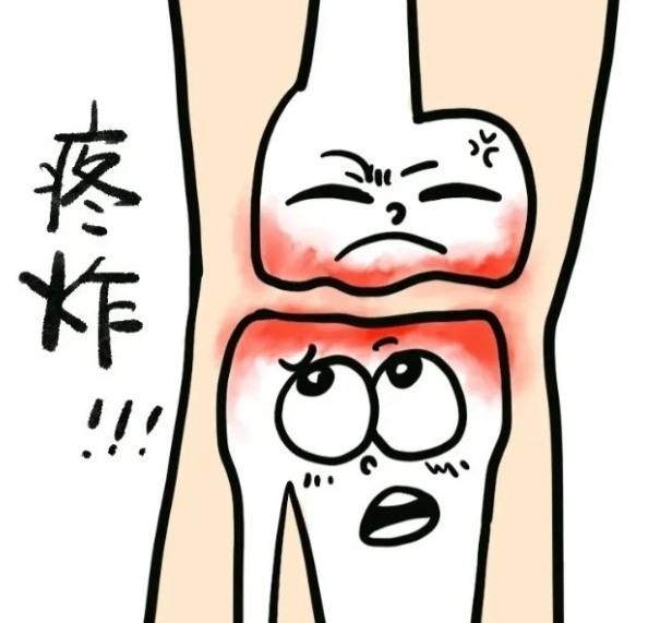 氨基葡萄糖的临床价值详解：维固力如何修复软骨强健关节？